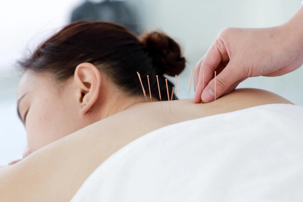 acupuncture for chronic pain relief